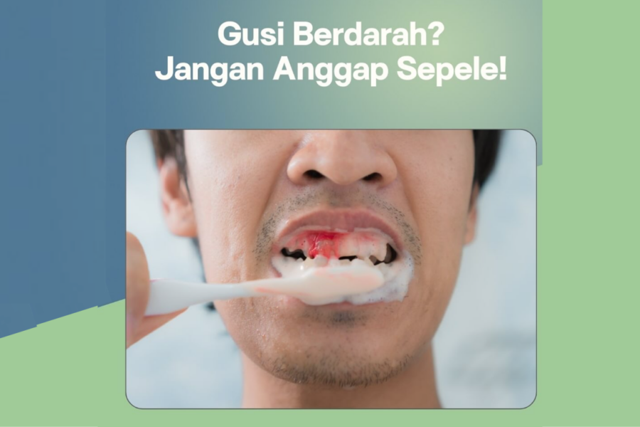 Gusi Berdarah: Penyebab, Dampak, dan Cara Mengatasinya