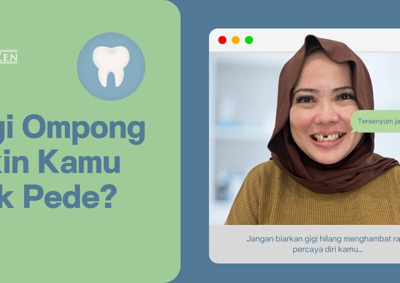Gigi Palsu: Solusi Nyaman dan Estetis untuk Gigi yang Hilang