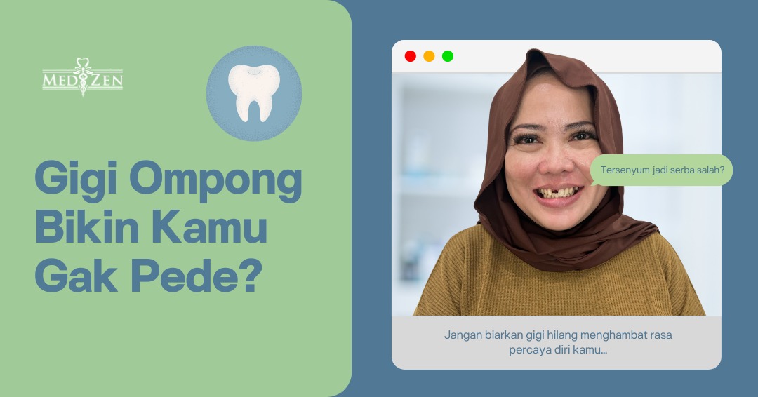 Gigi Palsu: Solusi Nyaman dan Estetis untuk Gigi yang Hilang