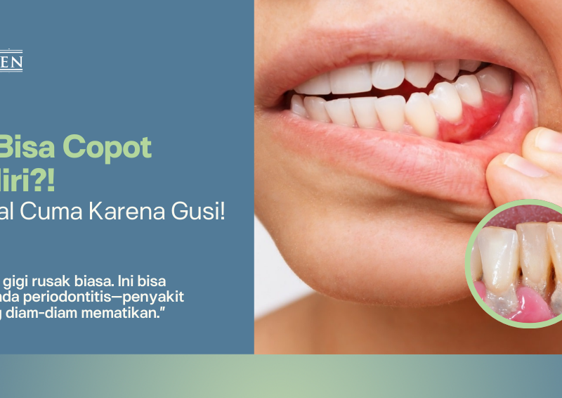 Waspadai Periodontitis: Penyakit Gusi yang Bisa Bikin Gigi Copot Tanpa Dicabut!