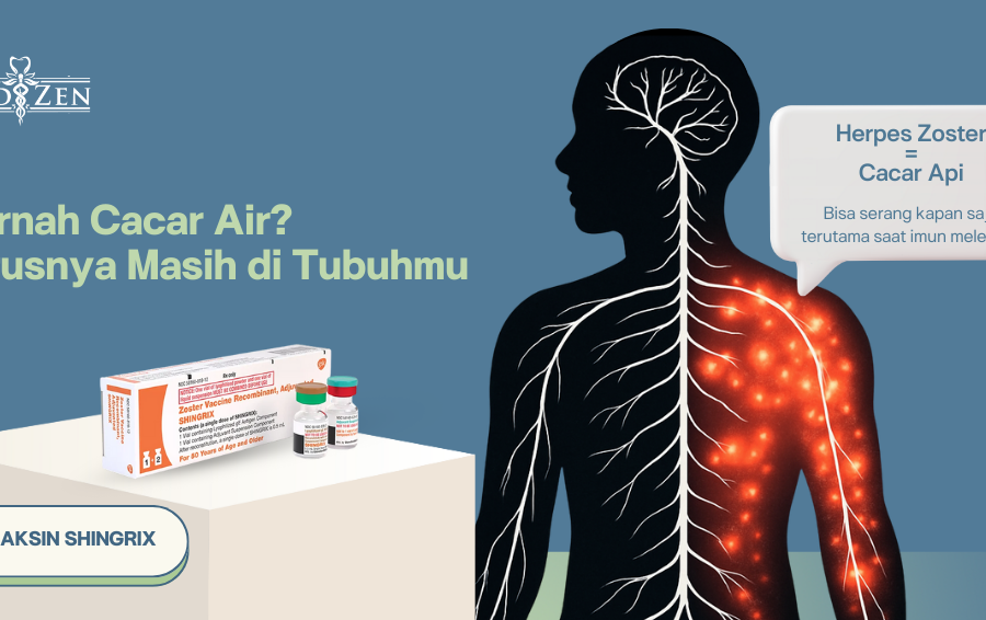 Herpes Zoster: Saat Virus Cacar Air Bangkit Kembali