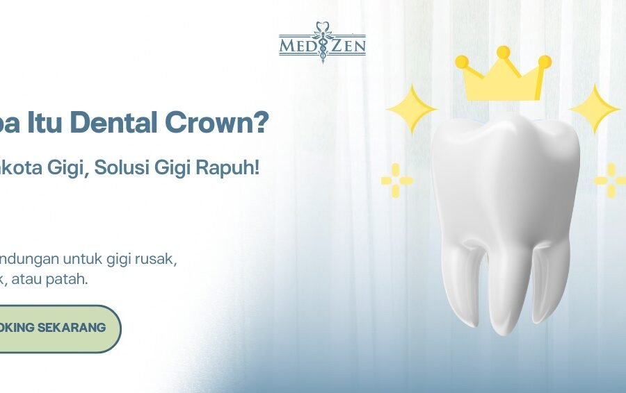Dental Crown: Solusi Cerdas untuk Gigi Rusak dan Senyum Lebih Percaya Diri