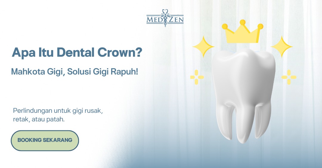 Dental Crown: Solusi Cerdas untuk Gigi Rusak dan Senyum Lebih Percaya Diri