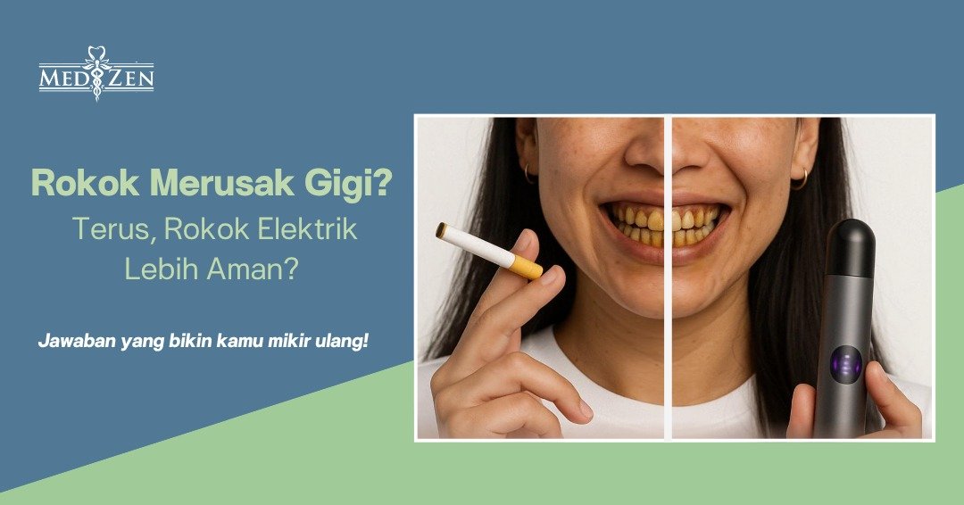 Rokok Merusak Gigi? Ini Fakta yang Perlu Kamu Tahu!