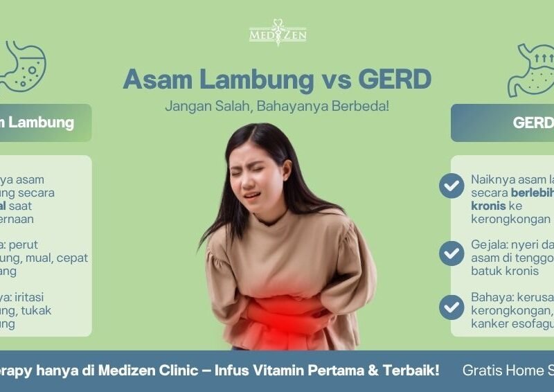 Perbedaan Asam Lambung dan GERD: Kenali Gejalanya, Hindari Bahayanya