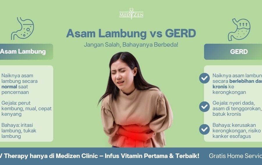Perbedaan Asam Lambung dan GERD: Kenali Gejalanya, Hindari Bahayanya