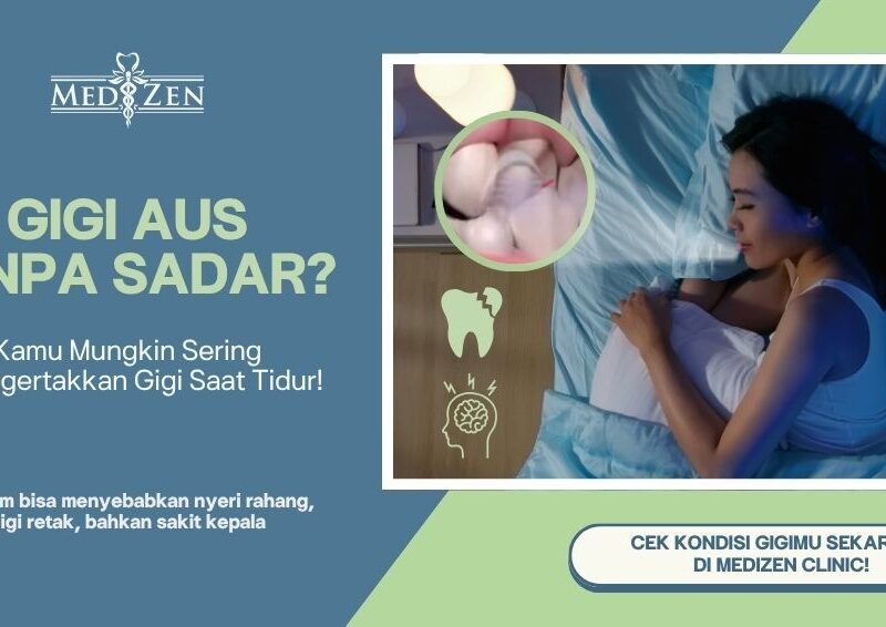 Menggertakkan Gigi Saat Tidur? Waspadai Bruxism Sebelum Terlambat!