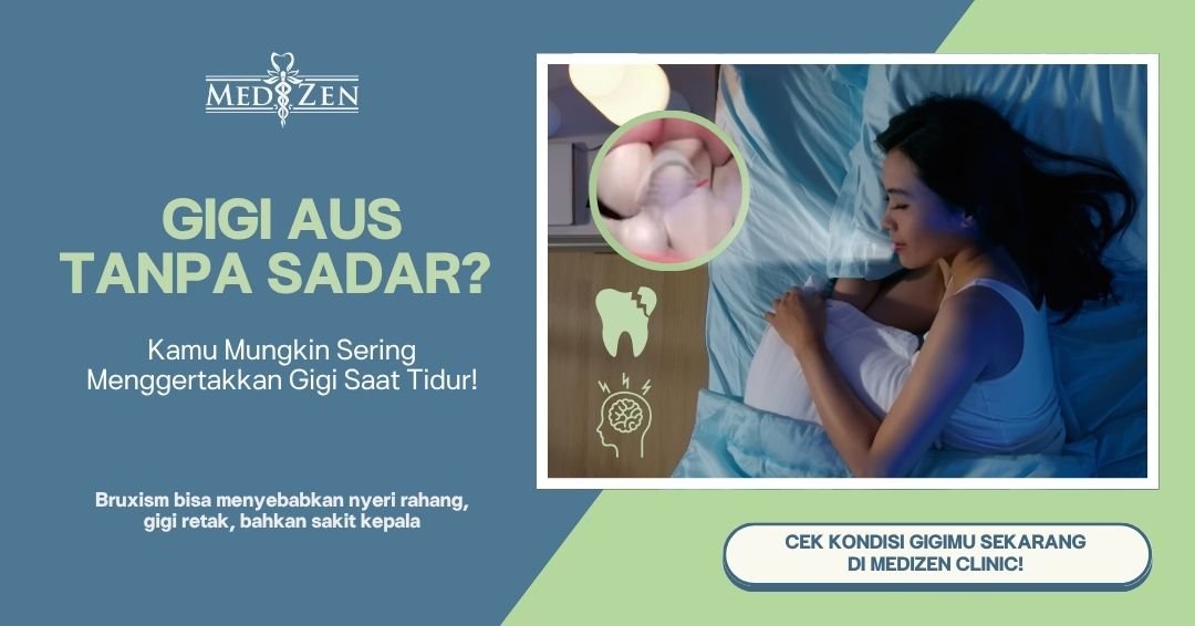 Menggertakkan Gigi Saat Tidur? Waspadai Bruxism Sebelum Terlambat!