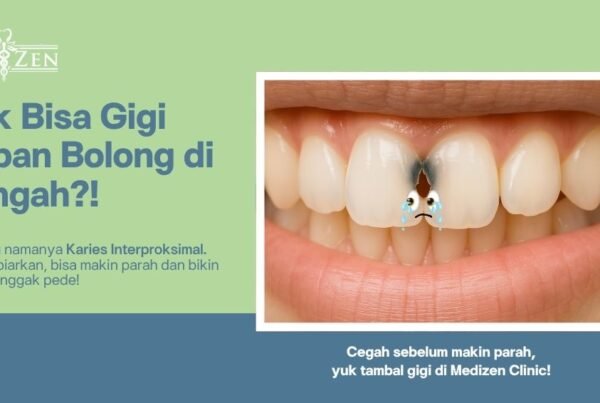 Karies Interproksimal: Si Gigi Bolong yang Sering Terabaikan di Tengah Dua Gigi Depan