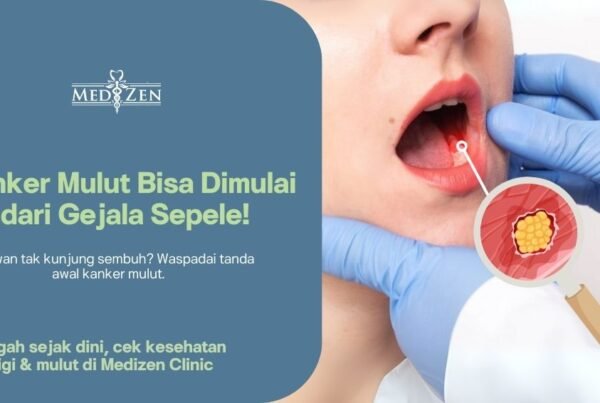 Kanker Mulut: Gejala, Penyebab, dan Pentingnya Deteksi Dini