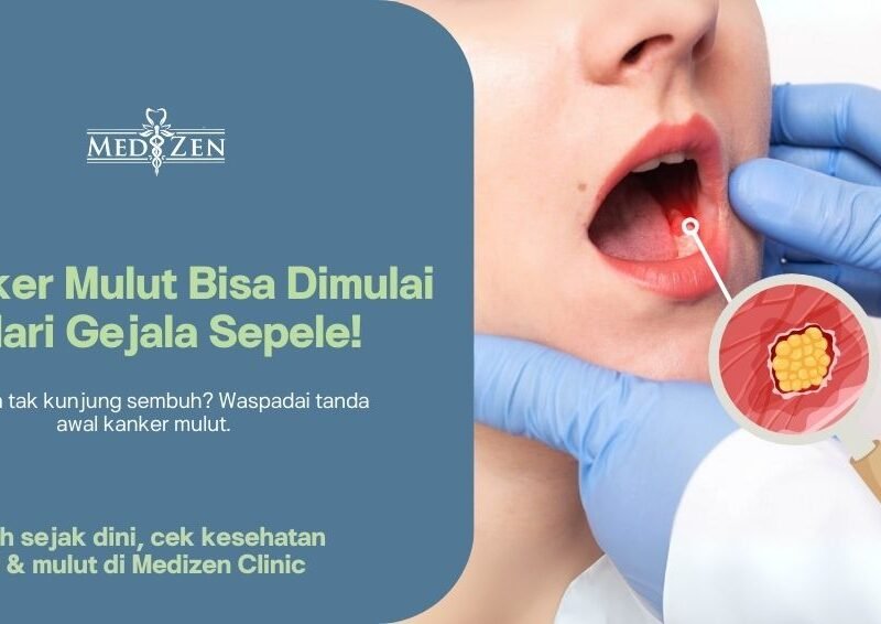 Kanker Mulut: Gejala, Penyebab, dan Pentingnya Deteksi Dini