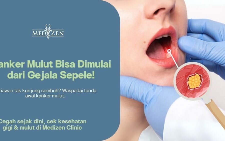 Kanker Mulut: Gejala, Penyebab, dan Pentingnya Deteksi Dini