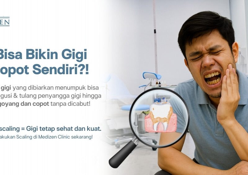 Apakah Karang Gigi yang Menumpuk Bisa Menyebabkan Gigi Copot dengan Sendirinya?