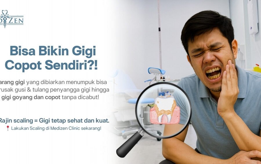 Apakah Karang Gigi yang Menumpuk Bisa Menyebabkan Gigi Copot dengan Sendirinya?