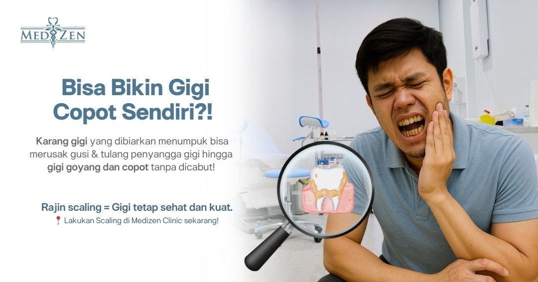 Apakah Karang Gigi yang Menumpuk Bisa Menyebabkan Gigi Copot dengan Sendirinya?