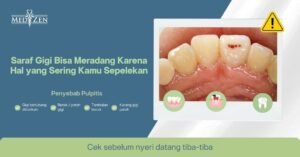 Radang Saraf Gigi (Pulpitis): Tinjauan Klinis, Dampak Keterlambatan Perawatan, dan Urgensi Pemeriksaan Dini di Medizen Clinic