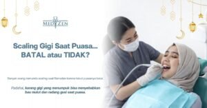 Boleh Tidak Scaling Gigi Saat Puasa? Ini Penjelasan Medis dan Solusinya