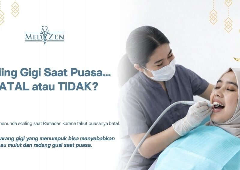 Boleh Tidak Scaling Gigi Saat Puasa? Ini Penjelasan Medis dan Solusinya