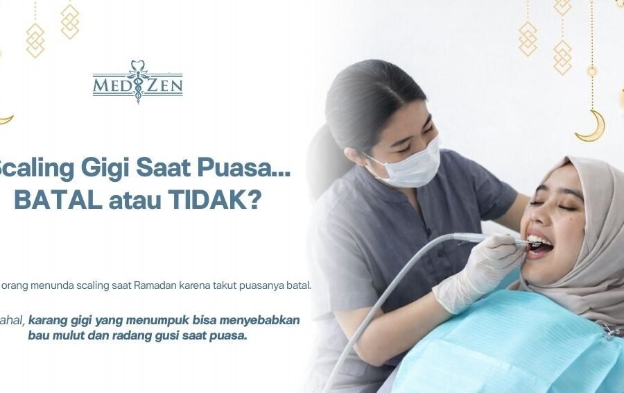 Boleh Tidak Scaling Gigi Saat Puasa? Ini Penjelasan Medis dan Solusinya