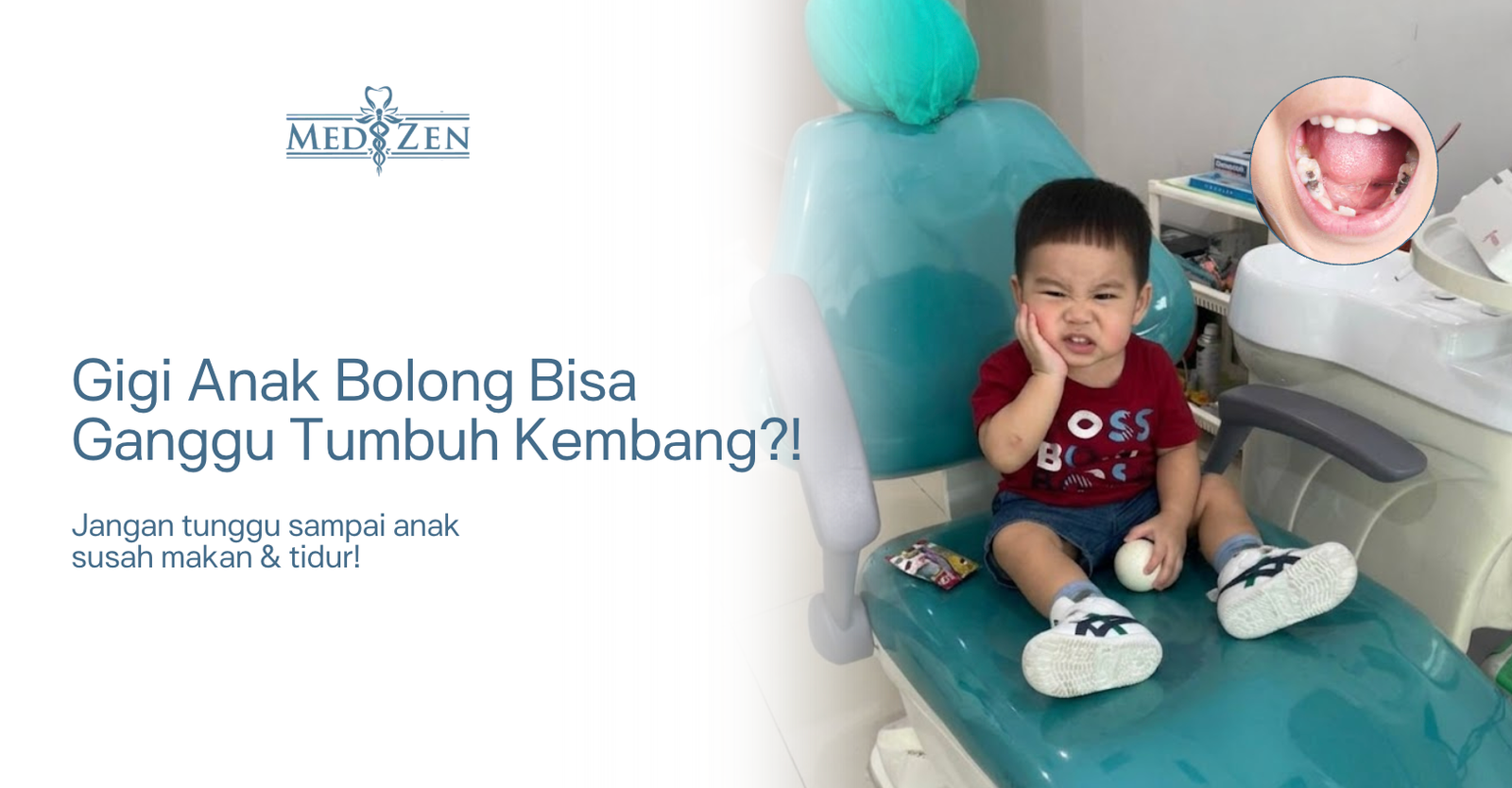 Masalah Kesehatan Gigi pada Anak: Kenali Sejak Dini untuk Mencegah Komplikasi