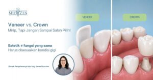 drg. Irene Kusumo Medizen Clinic Jakarta Selatan menjelaskan perbedaan veneer dan crown gigi