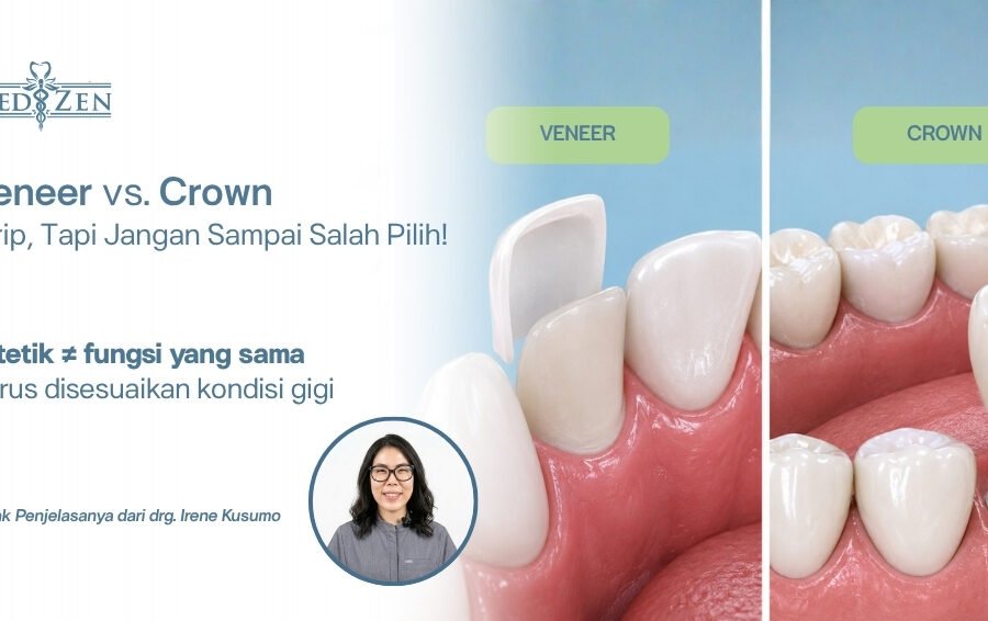 drg. Irene Kusumo Medizen Clinic Jakarta Selatan menjelaskan perbedaan veneer dan crown gigi
