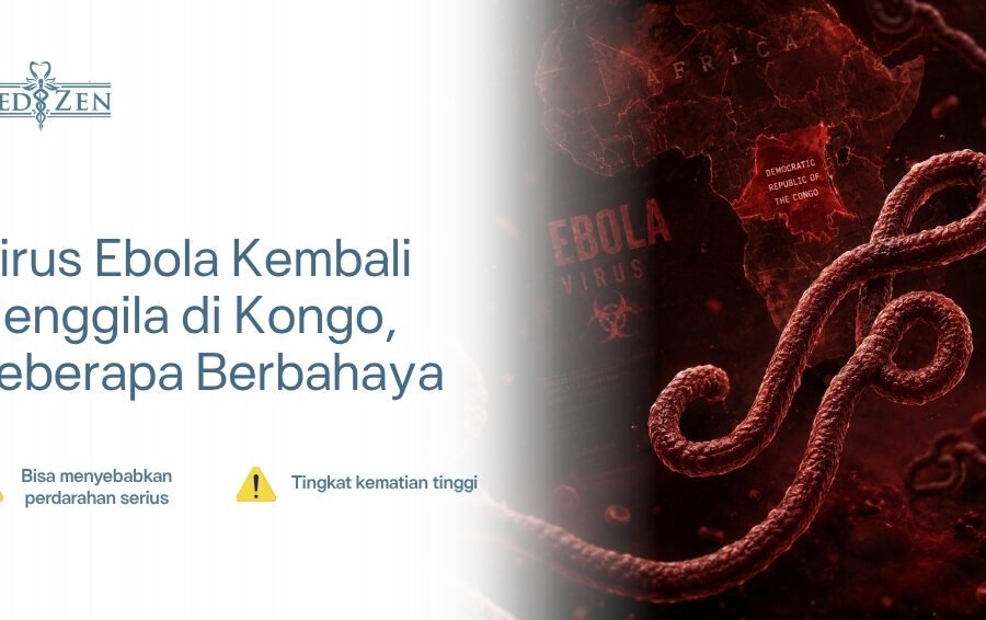Ilustrasi virus Ebola — struktur filovirus penyebab penyakit virus Ebola yang mematikan — Medizen Clinic Jakarta Selatan